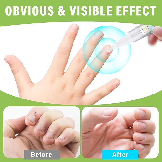 2Pcs Nail Biting Treatment for Kids, Nail Biting Prevention, Helping Adults and Children with Finger-Biting Habits to Stop Nail-Biting and Finger-Sucking Habits, Green