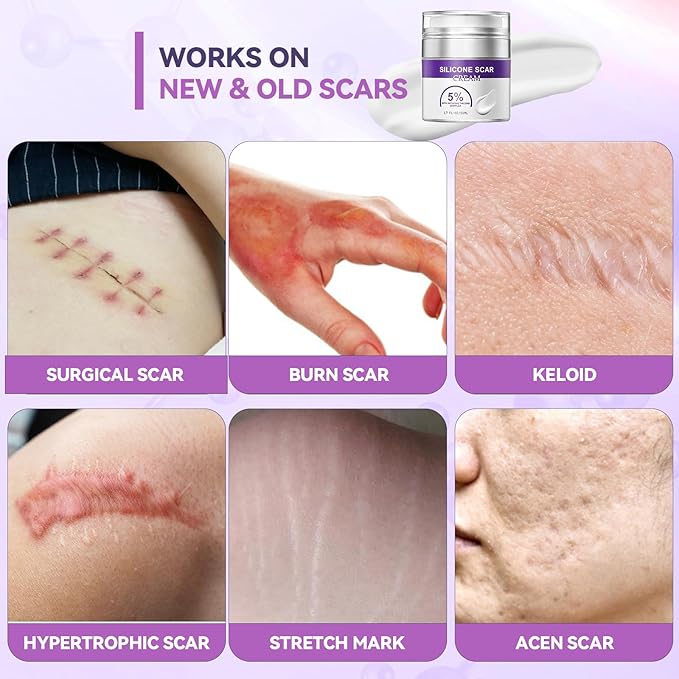 Advanced Scar Cream, Silicone Scar Gel for Old and New Scars, Scar Removal Cream for Surgical Scars, Stretch Marks, C-Section, Keloids, Injury, Acne, and More 1.7 oz(50ml)