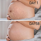 PEGO Stretch Mark Oil for Pregnancy, Maternity Body Oil for Stretch Mark Prevention & Reduction, Hydrating Skin Care, 4.06oz (2Pack)