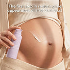 Evereden Nourishing Stretch Mark Cream (4 fl.oz): Clean & Vegan Cream for Pregnancy and Postpartum | Pregnancy Stretch Mark Prevention | Rich in Vitamins & Minerals