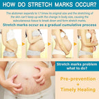 Stretch Mark Cream for Pregnancy - Deep Repair & Prevention for Stretch Marks - Stretch Mark Oil/Lotion for Women - Prenatal & Postnatal Skin Care (1_Pack)