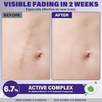 Silicone Scar Gel, Advanced Scar Cream for Burns & Acne Scars away, Stretch Marks, Surgical, Old & New, Surgery Scaraway Treatment, 1.7 oz (50ml)