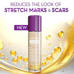 Cicatricure Cica Oil for Stretch Marks & Scars, Visible Results in 4 Weeks, Pregnancy Must-Haves Body Oil with Vitamin E, Stretch Mark Oil, Scar Treatment with Botanical Ingredients, 6.7 fl oz