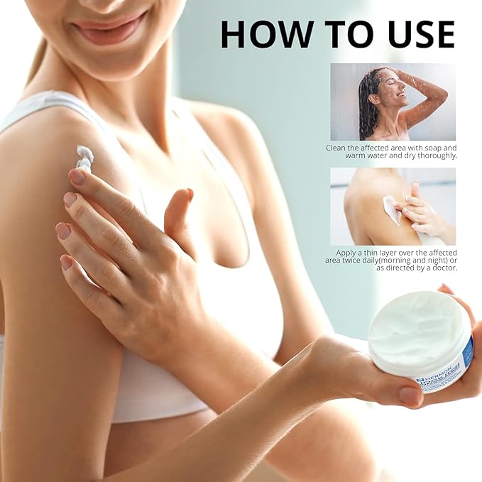 Hermon Jock Itch Antifungal Cream, Ringworm Treatment for Humans, Psoriasis Treatment, Psoriasis Scalp Treatment, Ringworm Cream for Humans, Foot & Body Balm, Provides Soothing Relief-100ml