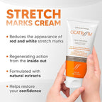Cicatrissim Stretch Mark Cream for Red and White Striae - Softens Stretch Marks, Evens Skin Tone, and Firms Skin - All Skin Types - 150g