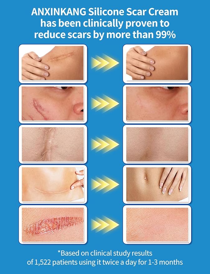 Silicone Scar Gel, Advanced Scar Cream treating for New and Old Scars, Surgical Scars, Burn Scars, Stretch Marks, Acne Scars, Dark markings, Keloid Removal 0.70 oz (20 g)