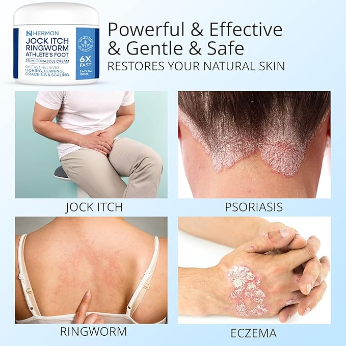Hermon Jock Itch Antifungal Cream, Ringworm Treatment for Humans, Psoriasis Treatment, Psoriasis Scalp Treatment, Ringworm Cream for Humans, Foot & Body Balm, Provides Soothing Relief-100ml