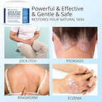 Hermon Jock Itch Antifungal Cream, Ringworm Treatment for Humans, Psoriasis Treatment, Psoriasis Scalp Treatment, Ringworm Cream for Humans, Foot & Body Balm, Provides Soothing Relief-100ml