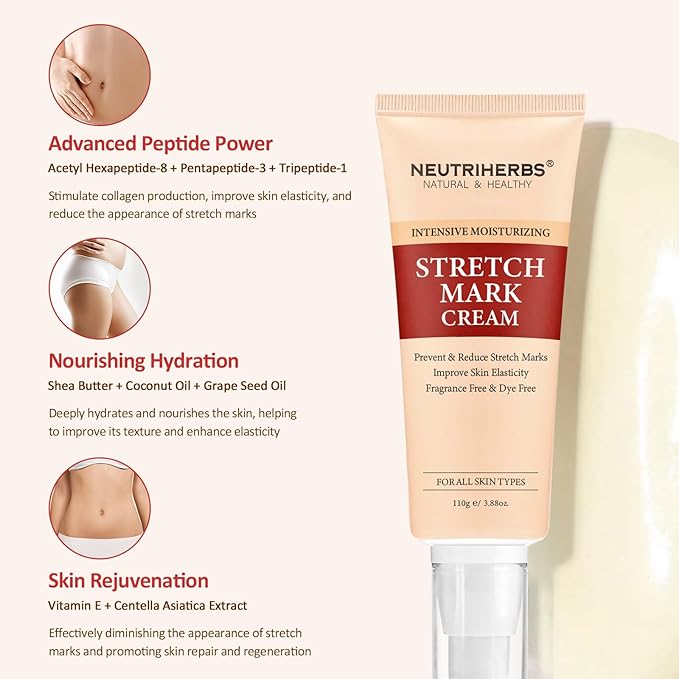 Neutriherbs Stretch Mark Cream, Pregnancy and Weight Fluctuations Skin Care, Belly Cream With Shea Butter and Coconut Oil - 3.88 Oz