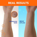 Zevo On-Body Tick & Mosquito Repellent Spray - 8-Hour Insect & Bug Spray - Odorless, Non-Sticky Formula for The Whole Family (1 Pump Bottle & 2 Aerosol Bottles)