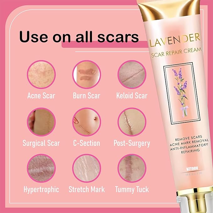 Lavender Scar Repair Cream for surgical scars, burns, acne, C-sections, stretch marks, keloids, and scar removal. Suitable for men and women. 1.7 oz. (1)