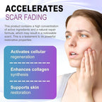 Silicone Scar Gel, Intensive Scar Cream, 2.1oz Keloid Bump Removal for Stretch Marks Removal, Surgical Scars, Cesarean Section, Acne, Injury, Burns, Doctor-tested Scar Improvement (60g)