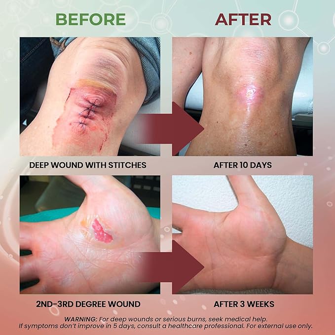 MediQuick Skin & Wound Care Hydrogel Drops - Quick Healing First Aid Drops with 12 Hours Action to Heal Cuts, Burns, Inflammation, Rash, Itch, Eczema & More - Safe Wound Wash with No-Sting - 4 Fl Oz