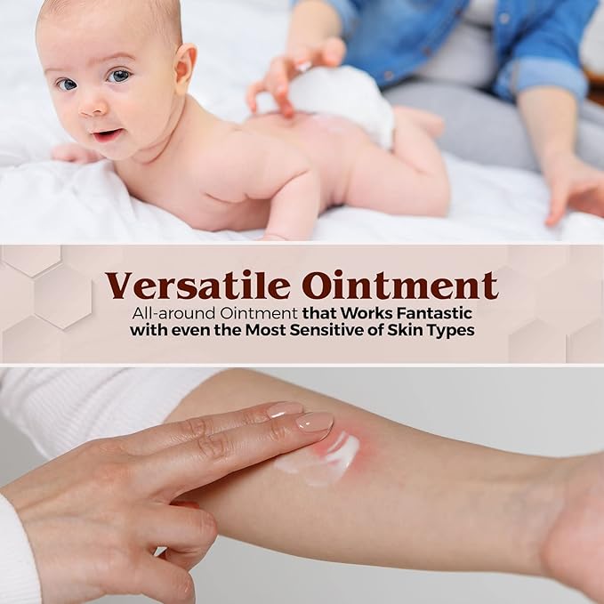 MEDca Vitamin A & D Diaper Rash Ointment- Protectant Cream for Sensitive Baby Skin - Lanolin & Petrolatum Formula, Dry-Cracked Hands/Feet/Face Skin, 1oz Tube, Pack of 6