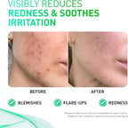 Hypochlorous Acid Spray for Face & Skin – Post-Workout Gentle HOCL Facial Cleanser for All Skin Types – After Workout Face Spray, Body Mist – Hydrating, Soothing & Calming Skincare – 8 Fl Oz