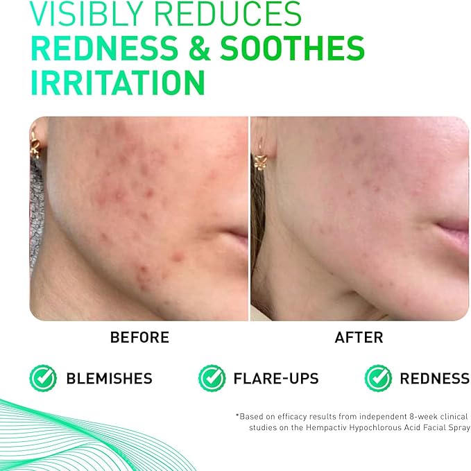 Hypochlorous Acid Spray for Face & Skin – Post-Workout Gentle HOCL Facial Cleanser for All Skin Types – After Workout Face Spray, Body Mist – Hydrating, Soothing & Calming Skincare – 8 Fl Oz