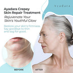 Crepey Skin Repair cream 8oz, Firming Lotion for Loose Skin, Crepe Corrector Collagen Cream for Body Tightening, Wrinkle Cream for Face, Neck, Arms and Legs, 500+ Uses