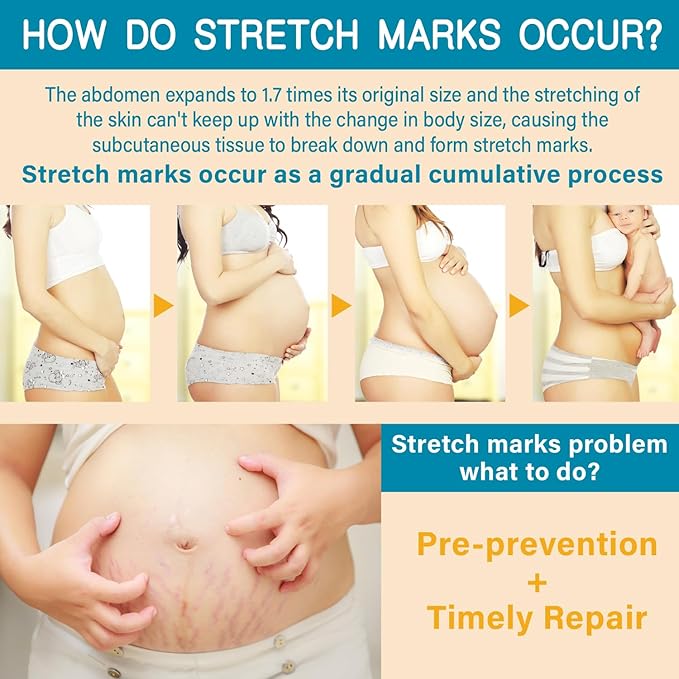 PEGO Stretch Mark Oil for Pregnancy, Maternity Body Oil for Stretch Mark Prevention & Reduction, Hydrating Skin Care, 2.03oz (1Pack)