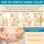PEGO Stretch Mark Oil for Pregnancy, Maternity Body Oil for Stretch Mark Prevention & Reduction, Hydrating Skin Care, 4.06oz (2Pack)