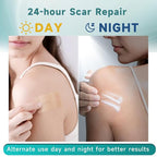 Advanced Silicone Scar Cream and Scar Sheets, Professional Scar Repair Kit for Surgical Scars, Stretch Marks, Old and New Scars