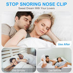 Anti Snoring Devices, Nasal Dilator for Sleeping, Effective to Relieve Snoring, for Nasal Snorers, Reusable Snoring Device to Enjoy a Peaceful Night's Sleep - 3 Pack (M)