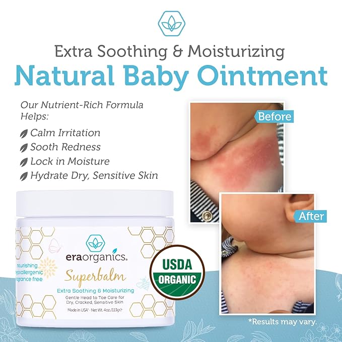 Era Organics Healing Ointment for Babies - USDA Certified Organic Natural Moisturizer Gentle on Sensitive Skin Prone To Baby Eczema, Cradle Cap (Infant Seborrheic Dermatitis), Rashes, Hives 4oz