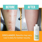 NOLEO Natural Skin Care – Deep Moisturizer for Sensitive Skin | Soothes Redness, Chafing & Irritation | Non-Toxic, EWG Verified, Organic | Face & Body Cream for Adults & Babies – 8oz