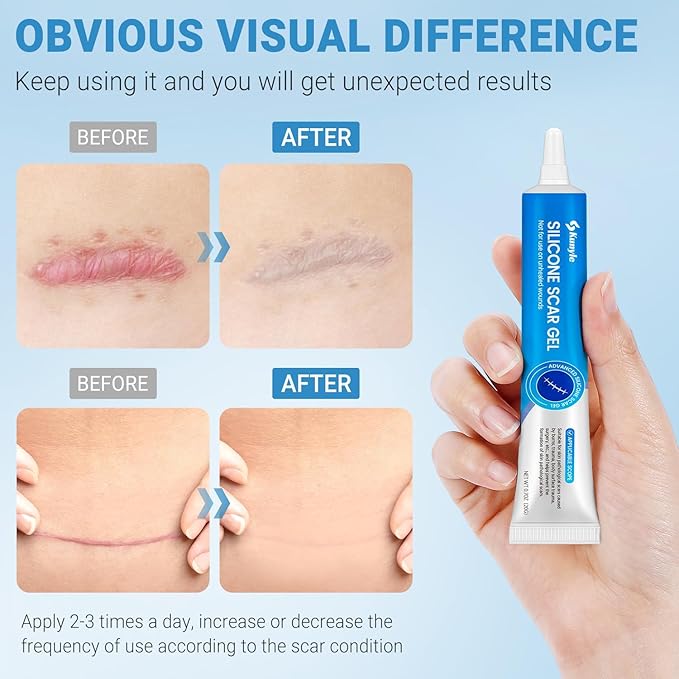 Silicone Scar Gel, Scar Cream, Advanced Scar Stick for Surgical Scars, Stretch Marks, Keloid Bump Removal, Old and New Scars 0.70oz (20g)
