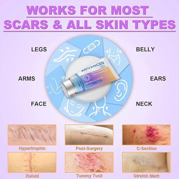 Silicone Scar Cream Scar Gel - Advanced Scar Treatment Keloid Bump Removal for Surgical Scars, C-Section, Injury, Stretch Marks, Acne, Burns, Keloids, Old & New Scars, 1.23Oz (35g)