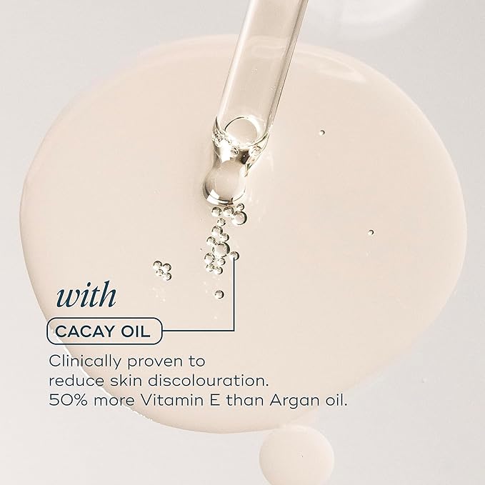 Luna Daily Stretch Mark Body Oil | Hydrating Treatment for Scars, Discoloration & Uneven Skin Texture | Vitamin C & Coconut Oil Nourish Dry Skin | Clinically Proven, Pregnancy Safe for Women, 300ml