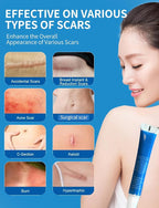 Silicone Scar Gel, Advanced Scar Cream treating for New and Old Scars, Surgical Scars, Burn Scars, Stretch Marks, Acne Scars, Dark markings, Keloid Removal 0.70 oz (20 g)