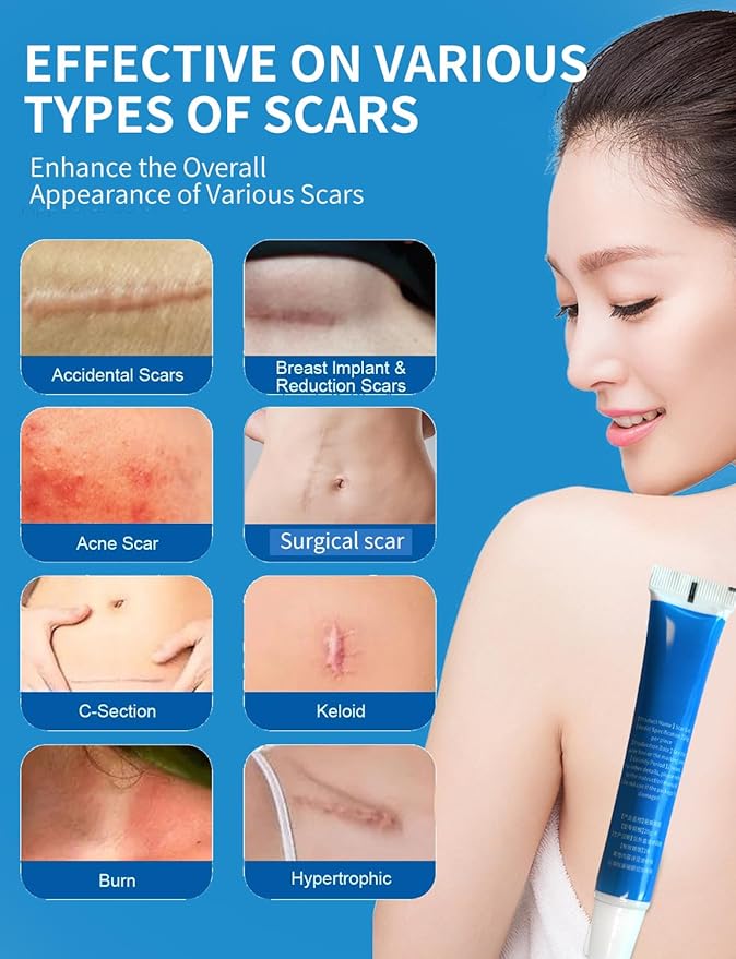Silicone Scar Gel, Advanced Scar Cream treating for New and Old Scars, Surgical Scars, Burn Scars, Stretch Marks, Acne Scars, Dark markings, Keloid Removal 0.70 oz (20 g)