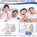 Anti Snoring Devices, Nasal Opener for Sleep Breathing, Increases Airflow, Three Adjustable Sizes, Individually Packaged, Easy to Carry - 4 Pack