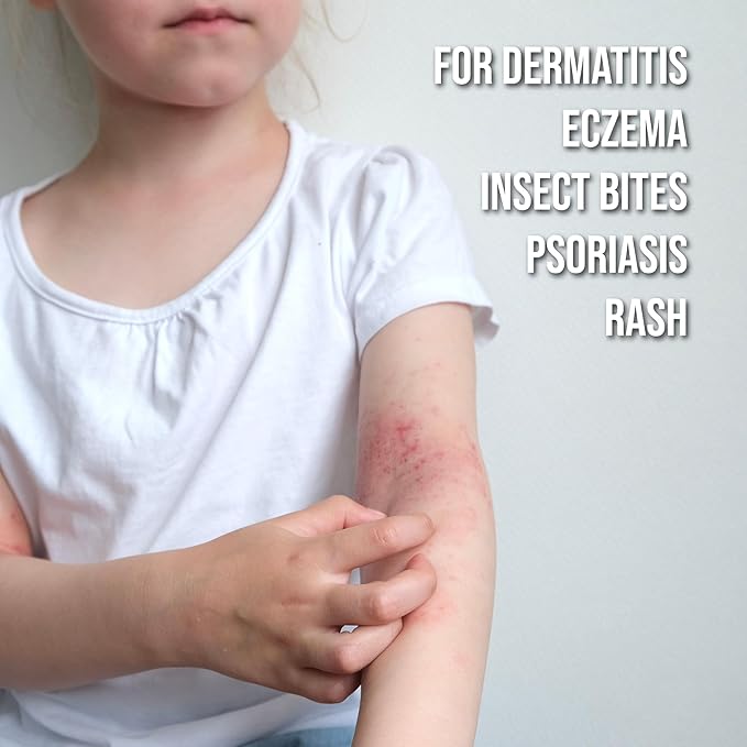 quitch Hydrocortisone Healing Balm, Eczema Cream for Kids Stick, Psoriasis Relief Treatment, Anti Itch Maximum Strength, Healing Ointment, Rash, Dry Skin Treatment for Skin, Avocado Oil Squalane