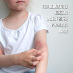 quitch Hydrocortisone Healing Balm, Eczema Cream for Kids Stick, Psoriasis Relief Treatment, Anti Itch Maximum Strength, Healing Ointment, Rash, Dry Skin Treatment for Skin, Avocado Oil Squalane