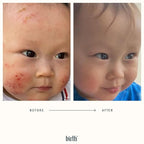 BIRTH SKINCARE Eczema Organic Baby Serum for Newborn and Infant, Redness Relief Moisturizer for Dry skin, Steroid Free 20z 59 ml Baby Ointment Body Serum for itchy Skin Relief, Made In Canada