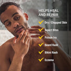 A+D Medicated Rash Ointment 15.2 oz– Relieves Irritated Skin from Poison Ivy, Eczema, Beard & Bikini Rash, Dry & Chapped Skin, Bug Bites. Made with Colloidal Oatmeal