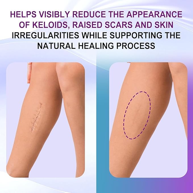 Silicone Scar Gel, Intensive Scar Cream, 2.1oz Keloid Bump Removal for Stretch Marks Removal, Surgical Scars, Cesarean Section, Acne, Injury, Burns, Doctor-tested Scar Improvement (60g)