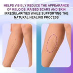 Silicone Scar Gel, Intensive Scar Cream, 2.1oz Keloid Bump Removal for Stretch Marks Removal, Surgical Scars, Cesarean Section, Acne, Injury, Burns, Doctor-tested Scar Improvement (60g)