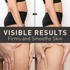 Enaskin Naturals Belly Firming Cream: B Flat Skin Tightening, Cellulite & Stretch Mark Reduction Cream for Stomach, Thighs and Booty - Hydrating Body Lotion for Women & Men, 3.38 Fl. Oz