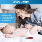 Zinc Oxide Ointment for Adults and Babies - 1 oz Diaper Rash Ointment - Skin Protectant for Diaper Rashes, Cuts, and Burns - 20% Zinc Oxide