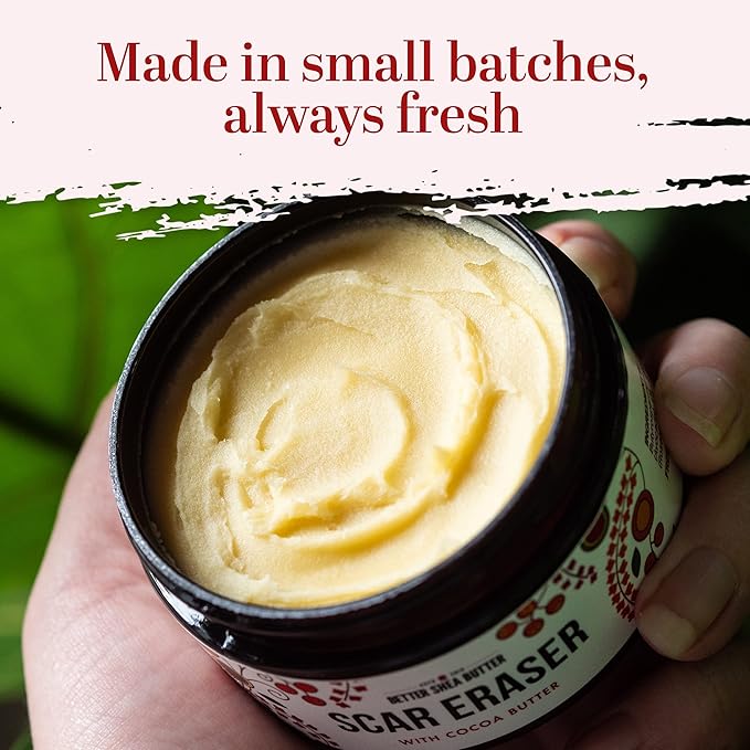 Better Shea Butter Scar Eraser Balm - Cocoa Butter Cream for Stretch Marks and Dark Spots, Burns, Old Scars - Acne Scars - Designed w Zero Synthetic Ingredients, 4 oz