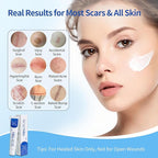 HBM Medical Grade Silicone Scar Gel, Advanced Scar Removal Cream for Old & New Scars, Stretch Marks, Surgical Scars, Keloids, Acne, C-Section & Burn Scars, 30g