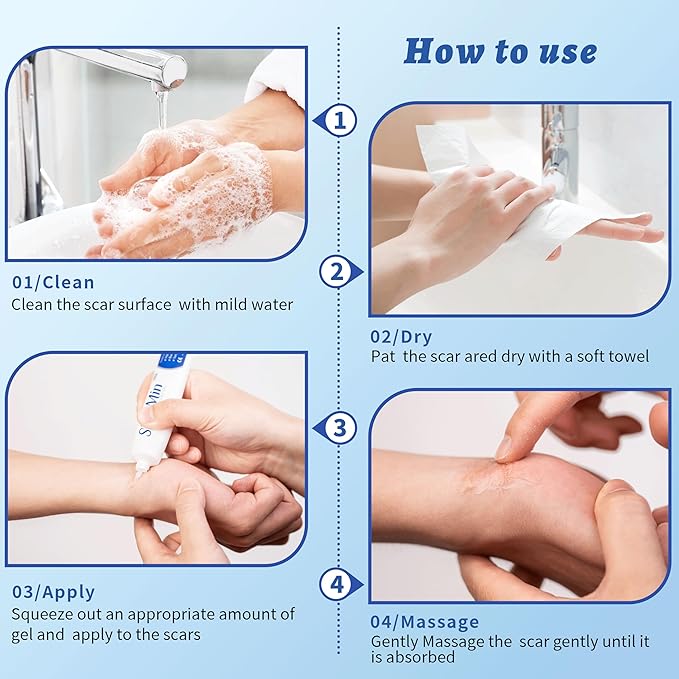 HBM Medical Grade Silicone Scar Gel, Advanced Scar Removal Cream for Old & New Scars, Stretch Marks, Surgical Scars, Keloids, Acne, C-Section & Burn Scars, 30g