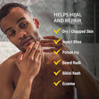 A+D Medicated Rash Ointment 1.5 oz– Relieves Rash & Skin Irritated Skin from Poison Ivy, Eczema, Beard Rash, Bikini Rash, Dry Skin, Chapped Skin, bug bites. Made with Colloidal Oatmeal