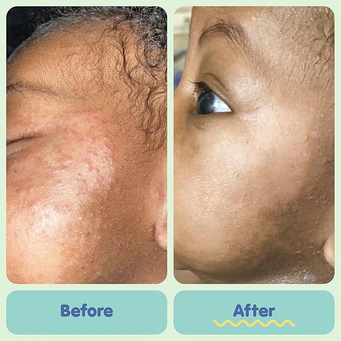 TUBBY TODD Baby Bundle Newborn Skin Care Set - Hypoallergenic Hair + Body Wash, All Over Ointment with Colloidal Oatmeal, Sweet Cheeks Diaper Paste - Lavender Rosemary, Standard Size