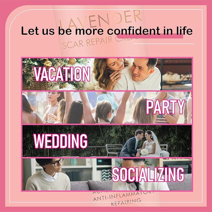 Lavender Scar Repair Cream for surgical scars, burns, acne, C-sections, stretch marks, keloids, and scar removal. Suitable for men and women. 1.7 oz. (1)