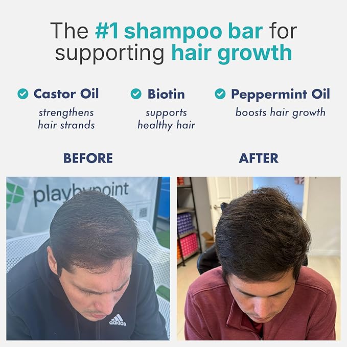 Castor Oil Shampoo Bar with Peppermint Essential Oils & Biotin - For Hair Growth, Strengthening, Thickening & Volumizing - Shampoo for Women and Men - Free of Parabens & Sulfates - Made in USA - 4.5oz