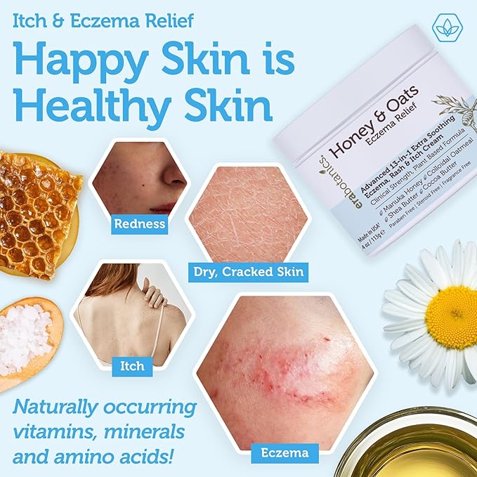 Eczema Cream with Manuka Honey & Colloidal Oatmeal – Extra Strength Anti Itch Cream for Dry, Sensitive Skin – Dermatitis & Itchy Skin Relief Moisturizer for Adults & Kids– Steroid Free Face & Body Use