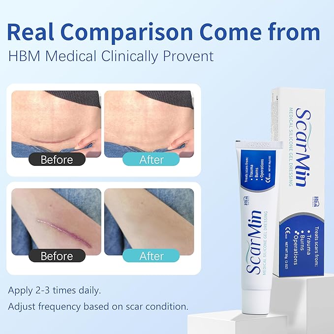 HBM Medical Grade Silicone Scar Gel, Advanced Scar Removal Cream for Old & New Scars, Stretch Marks, Surgical Scars, Keloids, Acne, C-Section & Burn Scars, 30g